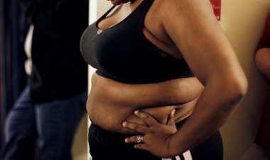 Obesity rising among Rwandans with more women affected: survey
